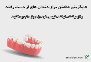 ایمپلنت 5 ایمپلنت دندانی تخصصی در مطب دکتر فائزه استاجی با ظاهری طبیعی و ماندگاری بالا